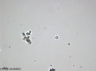 phyto/Bizerte/bizerte_bay/RISCO April 2014/Oxytoxum variabile (ancien O. turbo - 140729_001_ovl)(copy)_thumb.jpg